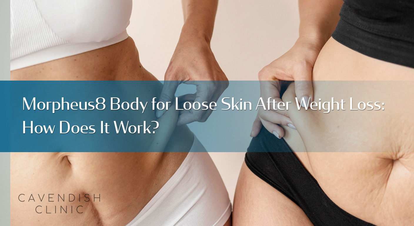 Morpheus8-Body-for-Loose-Skin-After-Weight-Loss