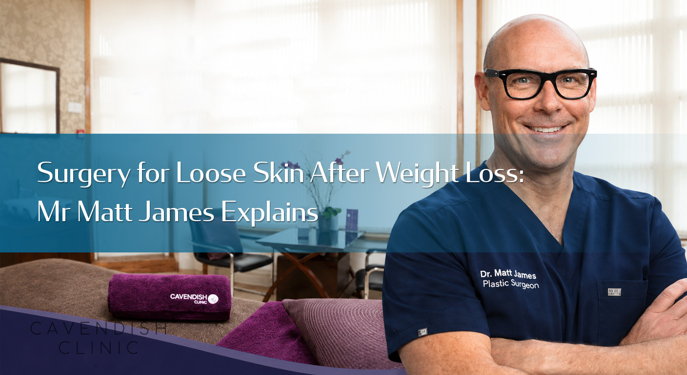 Surgery-for-Loose-Skin-After-Weight-Loss--Mr-Matt-James-Explains